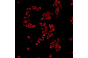 Immunofluorescence (IF) image for anti-Fused in Sarcoma (FUS) (AA 1-50) antibody (ABIN7454040) (Rekombinanter FUS Antikörper  (AA 1-50))