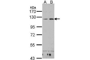 WB Image Sample(30 ug whole cell lysate) A:H1299 B:Hep G2 , 7.