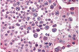 Human Testis (formalin-fixed, paraffin-embedded) stained with SIRPA antibody ABIN214476 at 2. (SIRPA Antikörper  (C-Term))