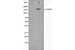 Western blot analysis on Jurkat cell lysate using TOP2B Antibody. (TOP2B Antikörper  (N-Term))