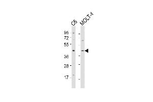 All lanes : Anti-CSNK2A1 Antibody  at 1:2000 dilution Lane 1: C6 whole cell lysates Lane 2: MOLT-4 whole cell lysates Lysates/proteins at 20 μg per lane.