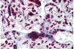 Human Placenta: Formalin-Fixed, Paraffin-Embedded (FFPE) (BAZ1B Antikörper  (AA 1384-1484))
