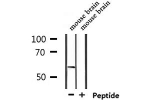 Western blot analysis of extracts from mouse brain, using USP17L Antibody. (USP17L9P Antikörper)