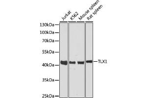 Western blot analysis of extracts of various cell lines, using TLX1 antibody (ABIN6131789, ABIN6149229, ABIN6149230 and ABIN6216643) at 1:3000 dilution. (TLX1 Antikörper  (AA 1-190))