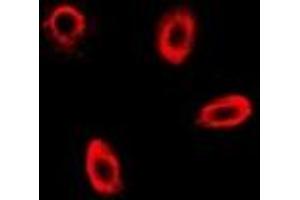 Immunofluorescent analysis of FBP1 staining in MCF7 cells.