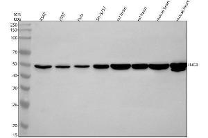 Western blot analysis of ING3 using anti-ING3 antibody (ABIN7825472).