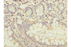 Immunohistochemistry of paraffin-embedded human small intestine tissue using ABIN7165370 at dilution of 1:100 (FAM118B Antikörper  (AA 83-351))