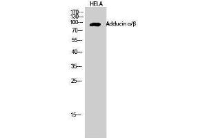 Western Blotting (WB) image for anti-Adducin alpha/beta (Lys5) antibody (ABIN3183186) (Adducin alpha/beta (Lys5) Antikörper)