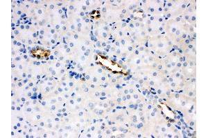 Anti-Glucose Transporter 8 antibody, IHC(P) IHC(P): Rat Kidney Tissue (SLC2A8 Antikörper  (C-Term))