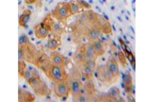 IHC-P analysis of Liver tissue, with DAB staining. (Hexosaminidase A Antikörper  (AA 319-528))
