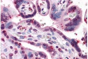 Immunohistochemistry (Formalin-fixed Paraffin-embedded Sections) (IHC (fp)) image for anti-Protein Kinase, CGMP-Dependent, Type I (PRKG1) (AA 73-171) antibody (ABIN574323)