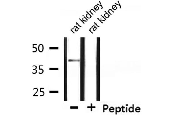 CCRL1 Antikörper  (C-Term)