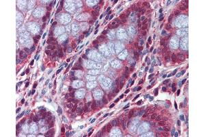 Anti-DACT2 antibody IHC of human colon. (DACT2 Antikörper  (N-Term))