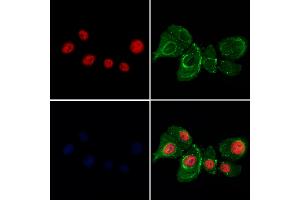 ABIN7094087 and ABIN7098131 staining Hela cells by IF/ICC. (BANP Antikörper  (C-Term))