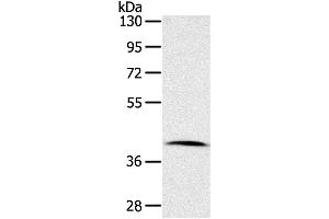 Western Blotting (WB) image for anti-Cyclin-Dependent Kinase 10 (CDK10) antibody (ABIN2421367) (CDK10 Antikörper)