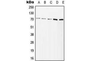 Western blot analysis of ZAP70 (pY315) expression in Jurkat H2O2-treated (A), HeLa H2O2-treated (B), Ramos lambda phosphatase-treated (C), mouse kidney (D), rat kidney (E) whole cell lysates. (ZAP70 Antikörper  (pTyr315))