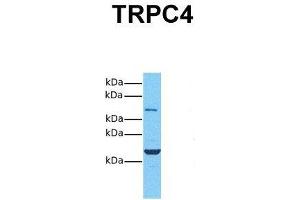 Host:  Rabbit  Target Name:  TRPC4  Sample Tissue:  Human 293T  Antibody Dilution:  1. (TRPC4 Antikörper  (Middle Region))