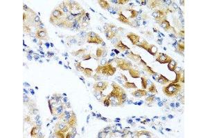 Immunohistochemistry of paraffin-embedded Human stomach using CCL21 Polyclonal Antibody at dilution of 1:100 (40x lens). (CCL21 Antikörper)