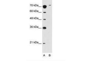 Image no. 2 for anti-Solute Carrier Family 7 (Cationic Amino Acid Transporter, Y+ System), Member 14 (SLC7A14) (AA 131-180) antibody (ABIN396880) (SLC7A14 Antikörper  (AA 131-180))