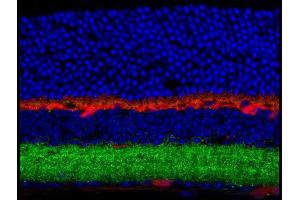 Immunohistochemistry of Anti-GABA(A) Receptor beta 3 (Rabbit) Antibody Immunohistochemistry of Anti-GABA(A) Receptor beta 3 (Rabbit) Antibody. (GABRB3 Antikörper  (Cytoplasmic Loop))