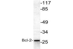Image no. 1 for anti-B-Cell CLL/lymphoma 2 (BCL2) antibody (ABIN265326) (Bcl-2 Antikörper)