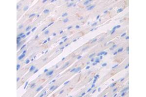 IHC-P analysis of heart tissue, with DAB staining. (Triadin Antikörper  (AA 344-693))