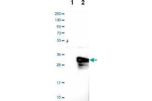 Western blot analysis of Lane 1: Negative control (vector only transfected HEK293T lysate), Lane 2: Over-expression lysate (Co-expressed with a C-terminal myc-DDK tag (~3. (ASB9 Antikörper)