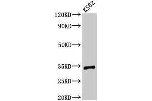 Western Blot Positive WB detected in: K562 whole cell lysate All lanes: TMEM177 antibody at 3 μg/mL Secondary Goat polyclonal to rabbit IgG at 1/50000 dilution Predicted band size: 34 kDa Observed band size: 34 kDa (TMEM177 Antikörper  (AA 219-311))