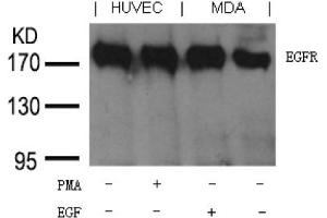 Image no. 1 for anti-Epidermal Growth Factor Receptor (EGFR) (Tyr1197) antibody (ABIN401656) (EGFR Antikörper  (Tyr1197))