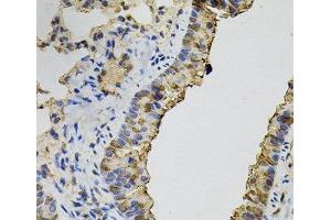 Immunohistochemistry of paraffin-embedded Mouse lung using DNM2 Polyclonal Antibody (DNM2 Antikörper)