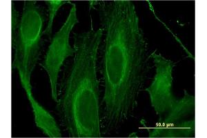 Immunofluorescence of monoclonal antibody to LRRK1 on HeLa cell. (LRRK1 Antikörper  (AA 560-659))