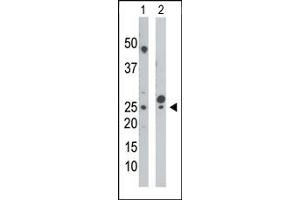 Western Blotting (WB) image for anti-Cytidine Monophosphate (UMP-CMP) Kinase 1, Cytosolic (CMPK1) (N-Term) antibody (ABIN360613) (Cytidine Monophosphate (UMP-CMP) Kinase 1, Cytosolic (CMPK1) (N-Term) Antikörper)