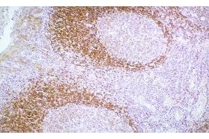 Image no. 1 for anti-Cadherin 1, Type 1, E-Cadherin (Epithelial) (CDH1) antibody (ABIN335398) (E-cadherin Antikörper)
