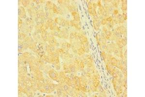 Immunohistochemistry of paraffin-embedded human liver tissue using ABIN7170352 at dilution of 1:100 (SNX14 Antikörper  (AA 601-893))