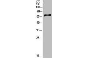 Western Blot analysis of mouse-brain cells using Antibody diluted at 800. (CYP26B1 Antikörper  (AA 391-440))