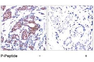 Image no. 2 for anti-ELK1, Member of ETS Oncogene Family (ELK1) (pSer383) antibody (ABIN196614) (ELK1 Antikörper  (pSer383))