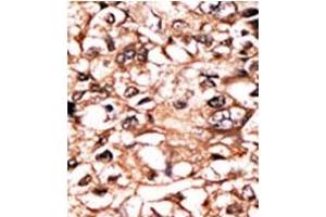 Image no. 1 for anti-Tumor Necrosis Factor Receptor Superfamily, Member 1A (TNFRSF1A) (pSer274) antibody (ABIN358242) (TNFRSF1A Antikörper  (pSer274))