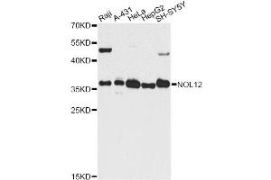 Western blot analysis of extracts of various cell lines, using NOL12 antibody.