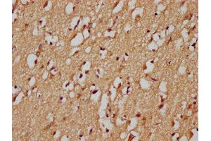 IHC image of ABIN7148390 diluted at 1:200 and staining in paraffin-embedded human brain tissue performed on a Leica BondTM system. (RHBDF1 Antikörper  (AA 132-221))