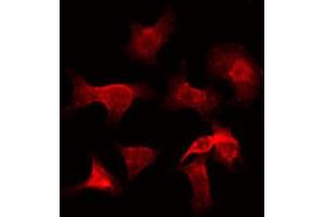 ABIN6272311 staining Hela by IF/ICC. (GZMH Antikörper)