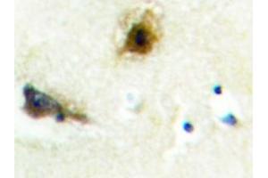 Image no. 1 for anti-Phosphofructokinase, Liver (PFKL) antibody (ABIN272176) (PFKL Antikörper)