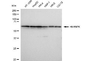 Western blotting analysis using HNRNPK antibody (ABIN7798900). (Rekombinanter HNRNPK Antikörper)