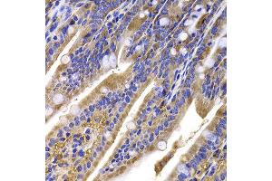 Immunohistochemistry of paraffin-embedded mouse ileum using HDGFRP2 antibody at dilution of 1:100 (x400 lens).