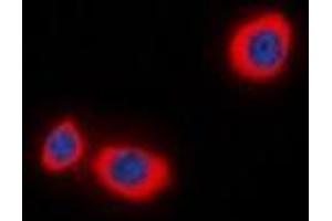 Immunofluorescent analysis of STMN1 (pS38) staining in MCF7 cells. (Stathmin 1 Antikörper  (N-Term, pSer38))