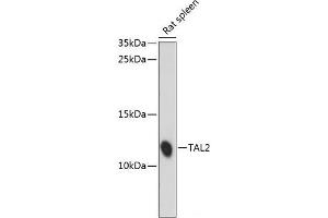 Western blot analysis of extracts of Rat spleen using TAL2 Polyclonal Antibody at dilution of 1:1000. (TAL2 Antikörper)