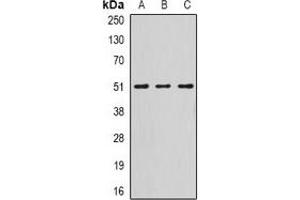 Western blot analysis of Serpin A10 expression in HepG2 (A), mouse liver (B), rat liver (C) whole cell lysates. (SERPINA10 Antikörper)