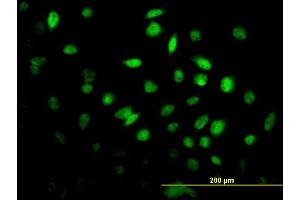 Immunofluorescence of monoclonal antibody to FOXF2 on HeLa cell. (FOXF2 Antikörper  (AA 346-443))