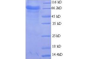 SDS-PAGE (SDS) image for Aspartyl Aminopeptidase (DNPEP) (AA 1-475), (full length) protein (His-SUMO Tag) (ABIN5709411)