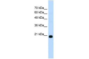 FBXO25 antibody used at 1.