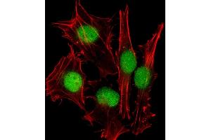 Immunofluorescent analysis of 4 % paraformaldehyde-fixed, 0. (SUMO1 Antikörper)